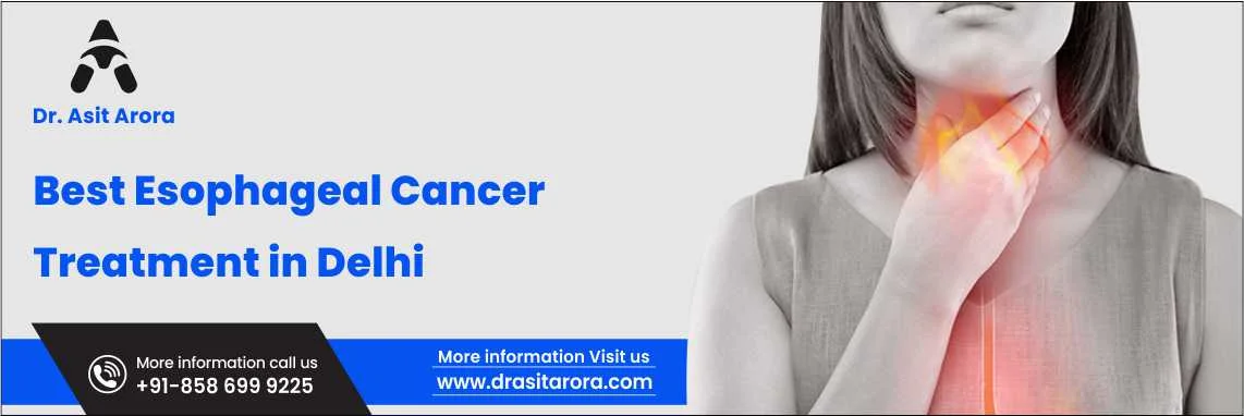 Best Esophageal Cancer Treatment in Delhi