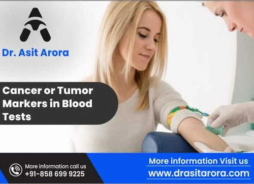 Cancer or Tumor Markers in Blood Tests