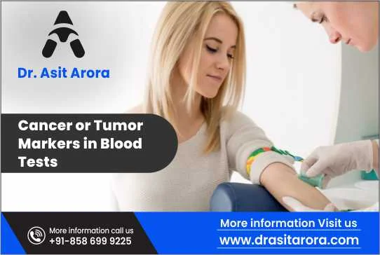 Cancer or Tumor Markers in Blood Tests