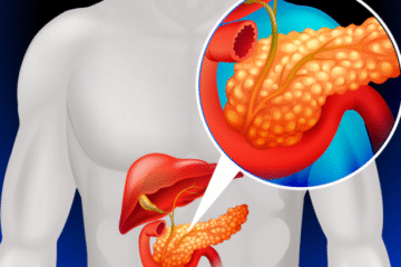 Pancreatic Cancer: Symptoms, Diagnosis & Advanced Treatment Options | Dr. Asit Arora