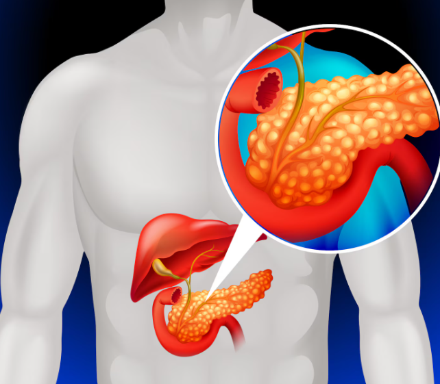 Pancreatic Cancer: Symptoms, Diagnosis & Advanced Treatment Options | Dr. Asit Arora