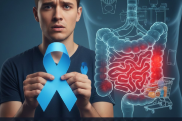 Colon Cancer Under 50