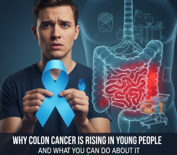 Colon Cancer Under 50