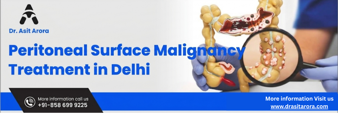 Best Peritoneal Surface Malignancy Treatment in Delhi