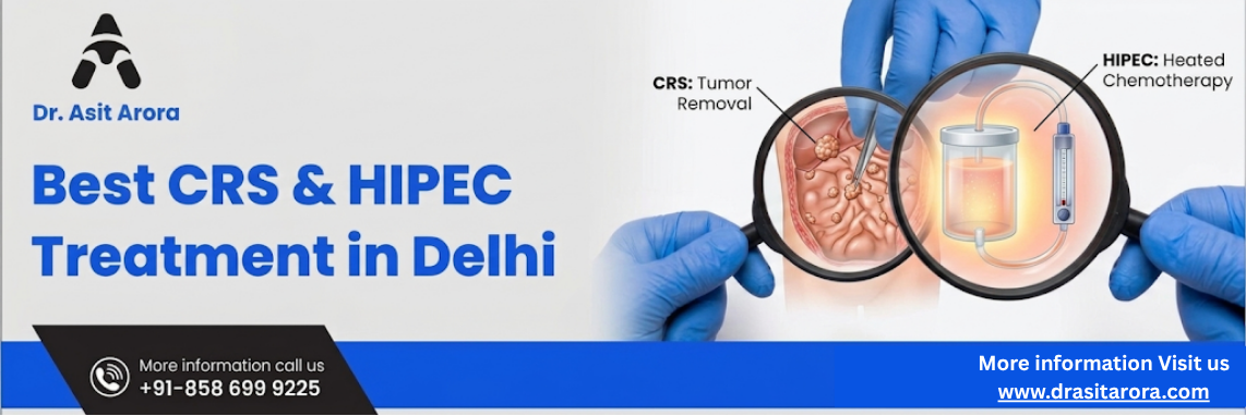 Best CRS & HIPEC Treatment in Delhi