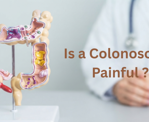 Is a Colonoscopy Painful? Understanding the Colonoscopy Procedure