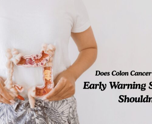 Colon cancer treatment in Delhi
