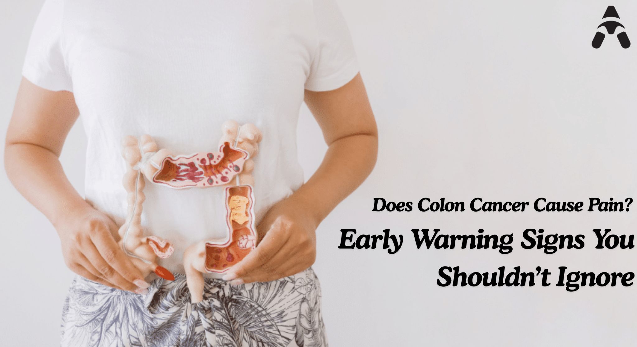 Colon cancer treatment in Delhi