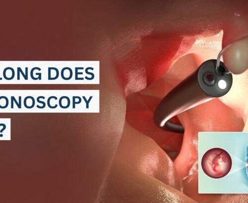 How long does a colonoscopy take and what to expect during the procedure