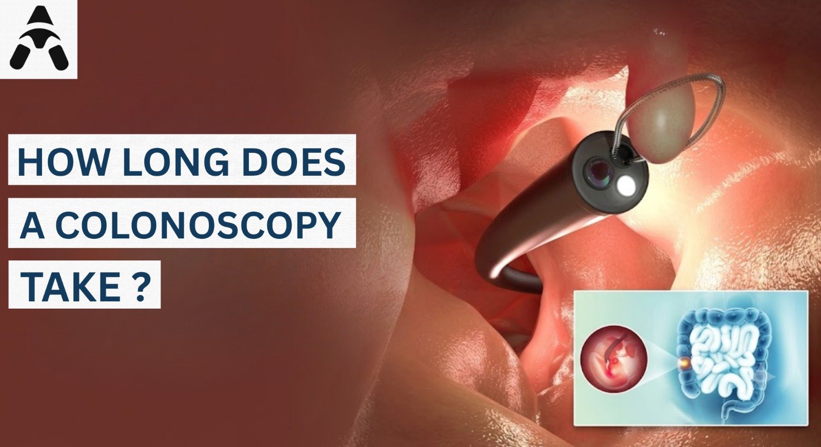 How long does a colonoscopy take and what to expect during the procedure