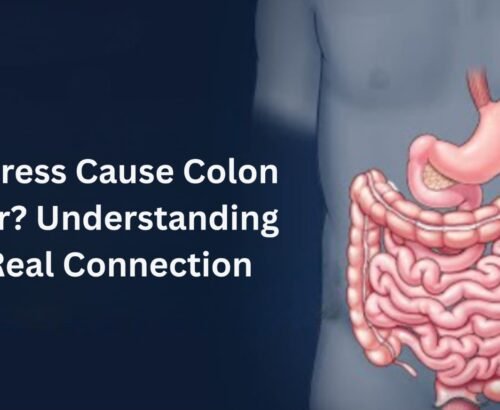 Can Stress Cause Colon Cancer