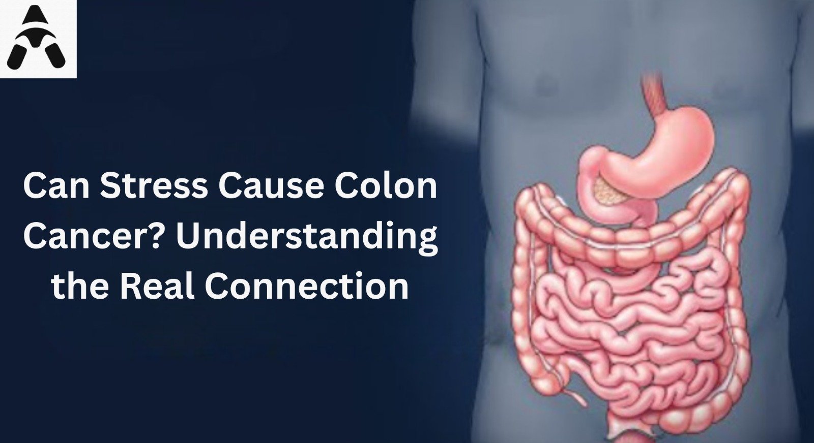 Can Stress Cause Colon Cancer