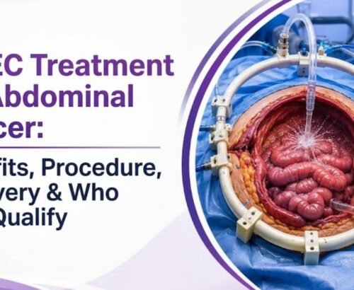 HIPEC Treatment in Delhi for Abdominal Cancer