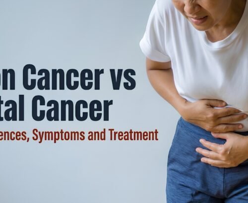 Colon Cancer vs Rectal Cancer in India